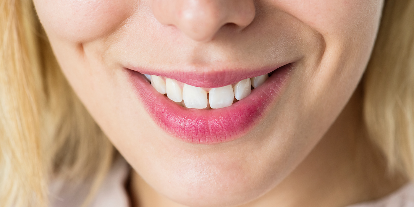 Sorriso perfeito é sinônimo de sorriso saudável?